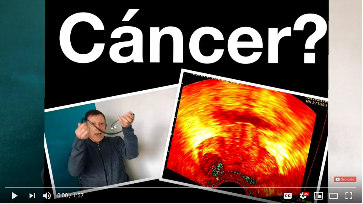 Detectando c�ncer sin riesgo ni dolor
